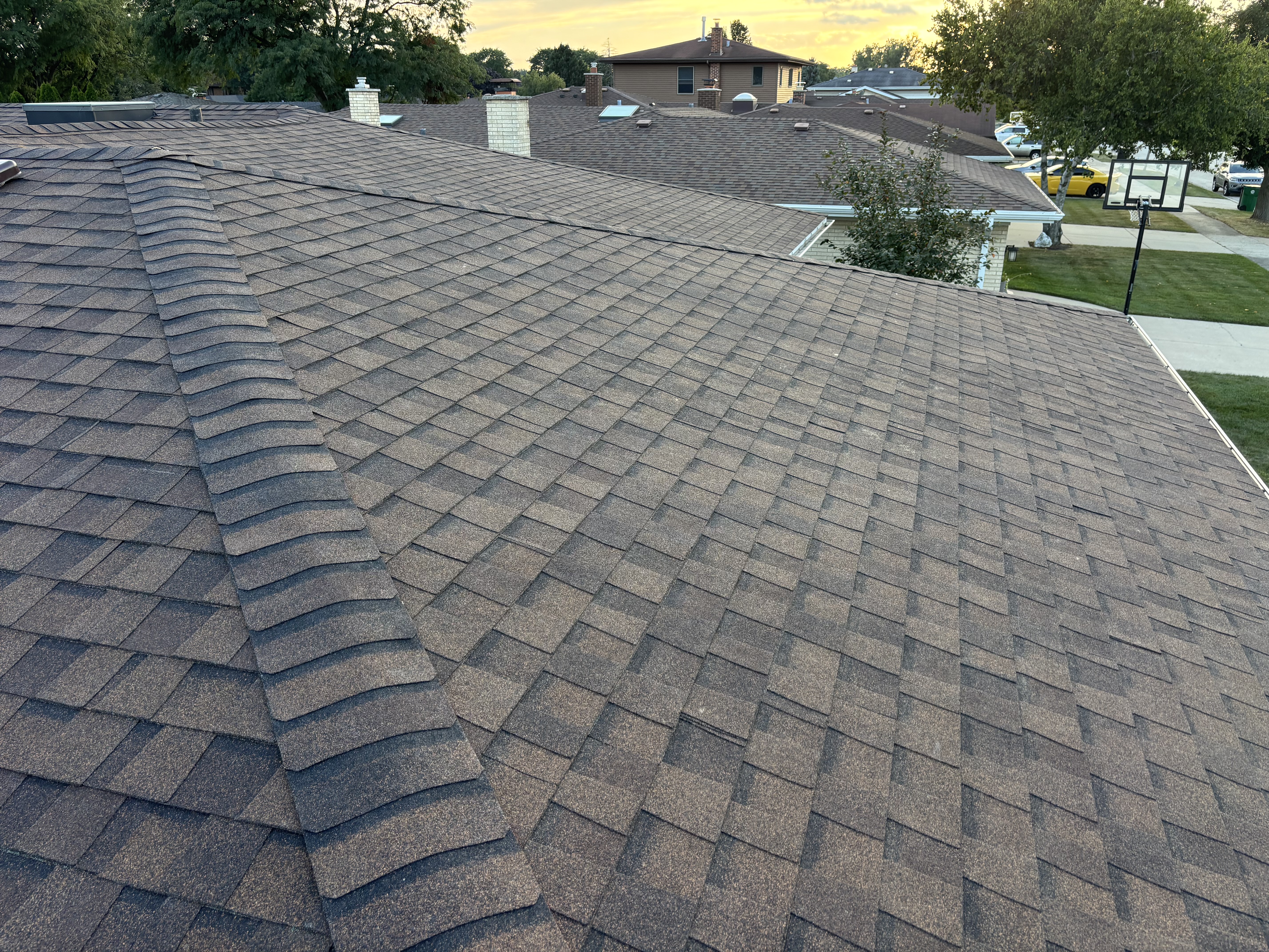 Shingles
